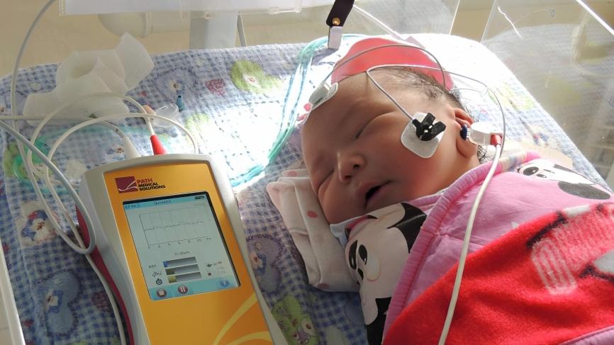 الكشف المبكر عن نقص السمع لدى حديثي الولادة 